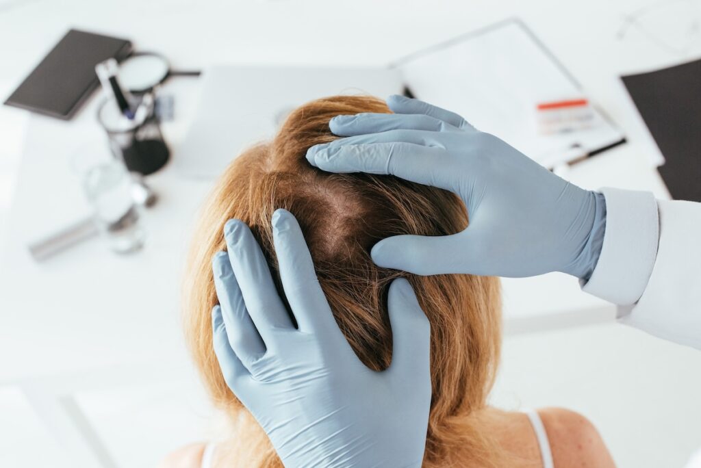 overhead view of dermatologist in blue latex gloves examining hair of patient in clinic