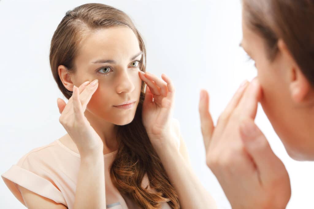 Woman touching the sunken parts of her fae, in need of Sculptra treatment to even it out