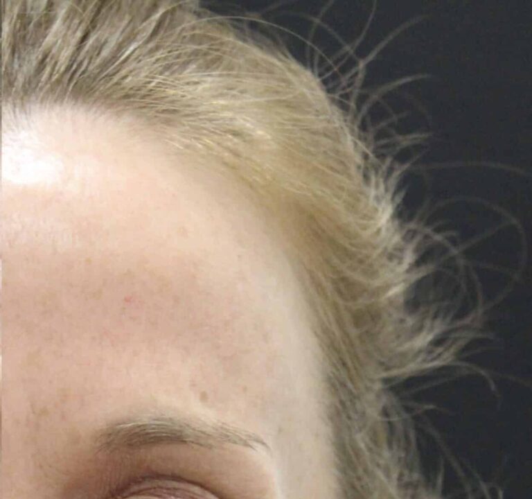 After Image: Neurotoxin - front