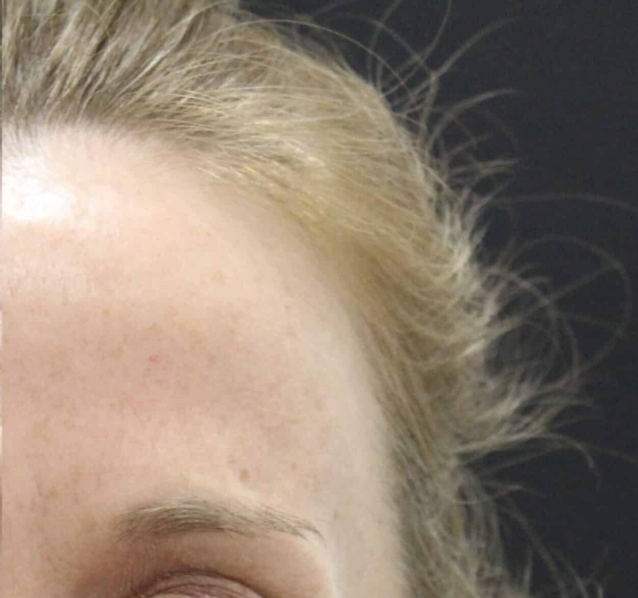 After Image: Neurotoxin - front