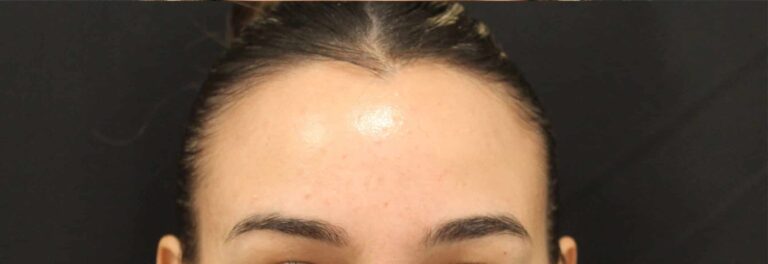 After Image: Neurotoxin - front