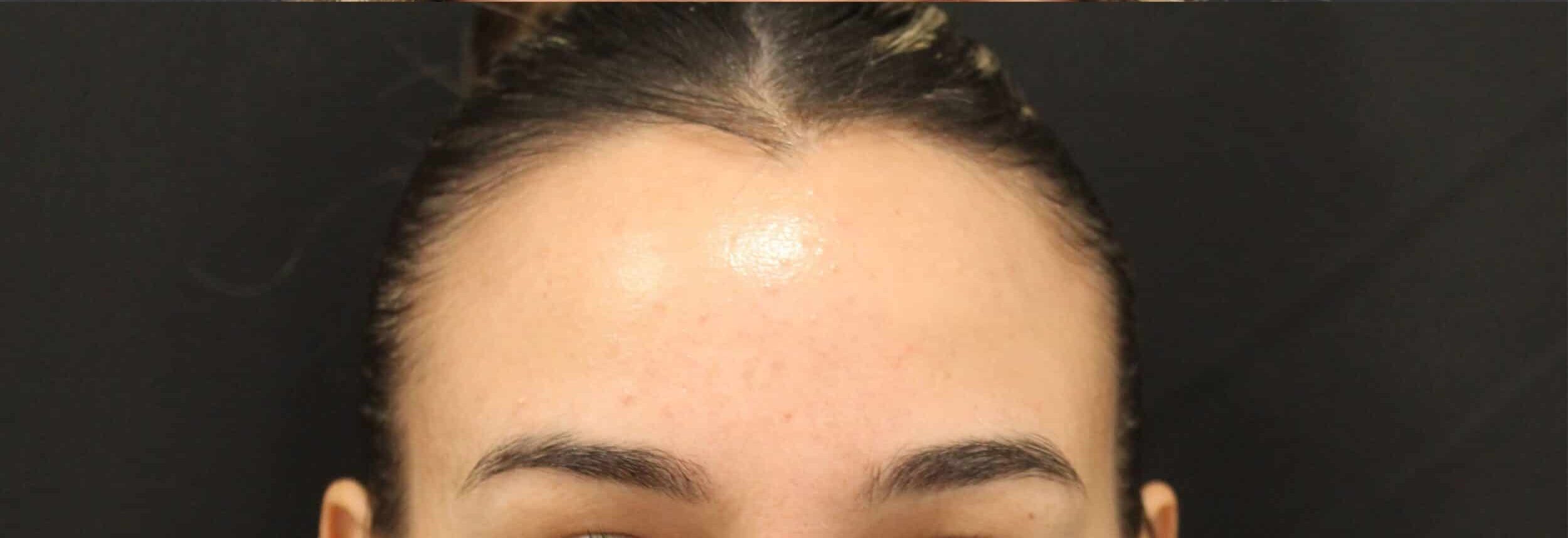 After Image: Neurotoxin - front