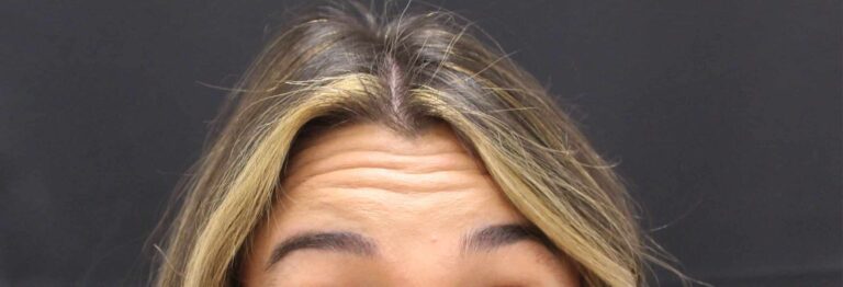 Before Image: Neurotoxin - front