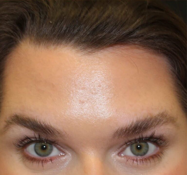 After Image: Neurotoxin - front
