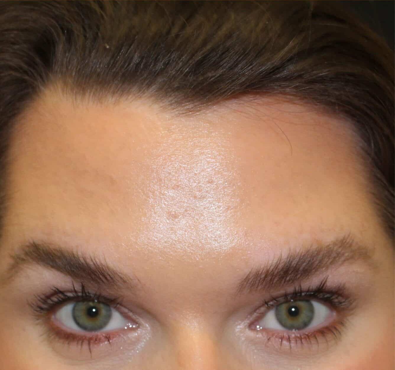 After Image: Neurotoxin - front