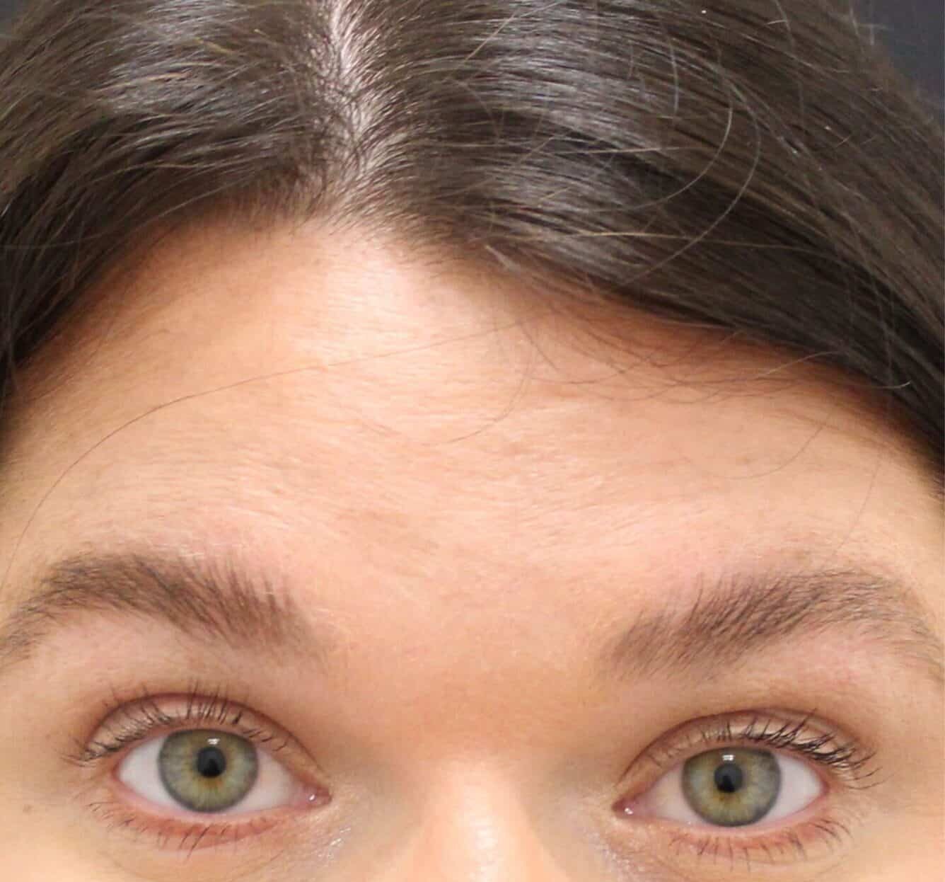 Before Image: Neurotoxin - front