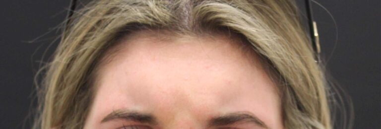 Before Image: Neurotoxin - front