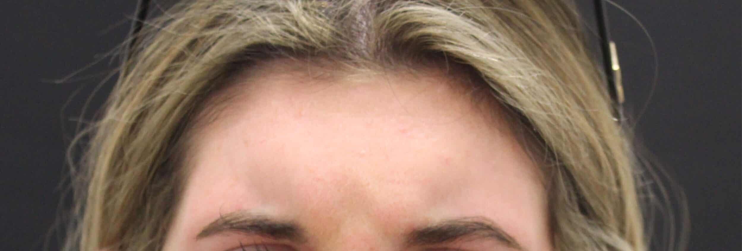Before Image: Neurotoxin - front