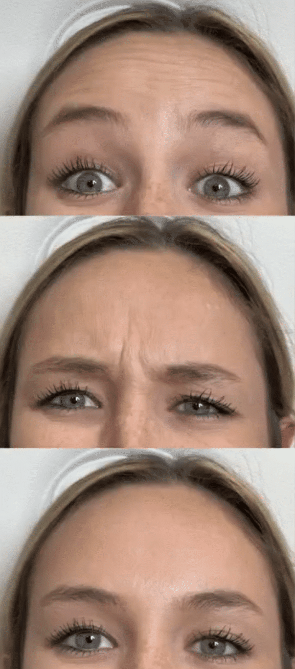 Before Image: Neurotoxin - front