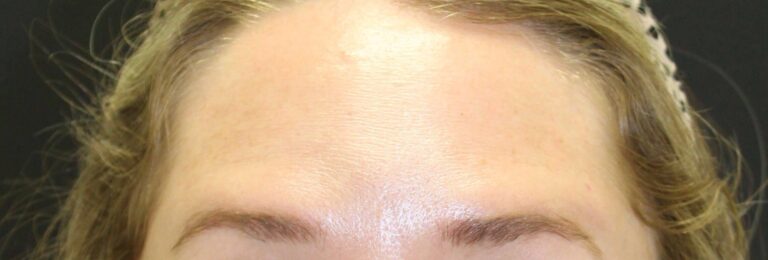 After Image: Neurotoxin - front