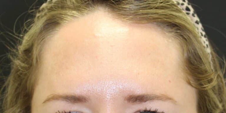 After Image: Neurotoxin - front