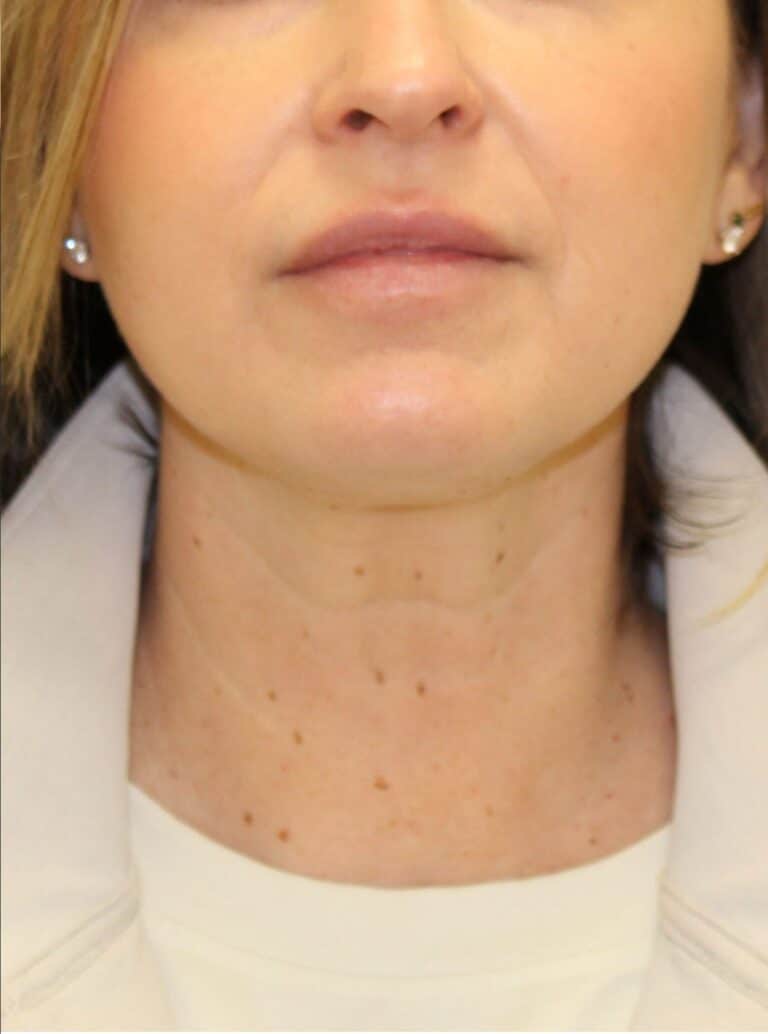 After Image: Timeless Neck Protocol - front