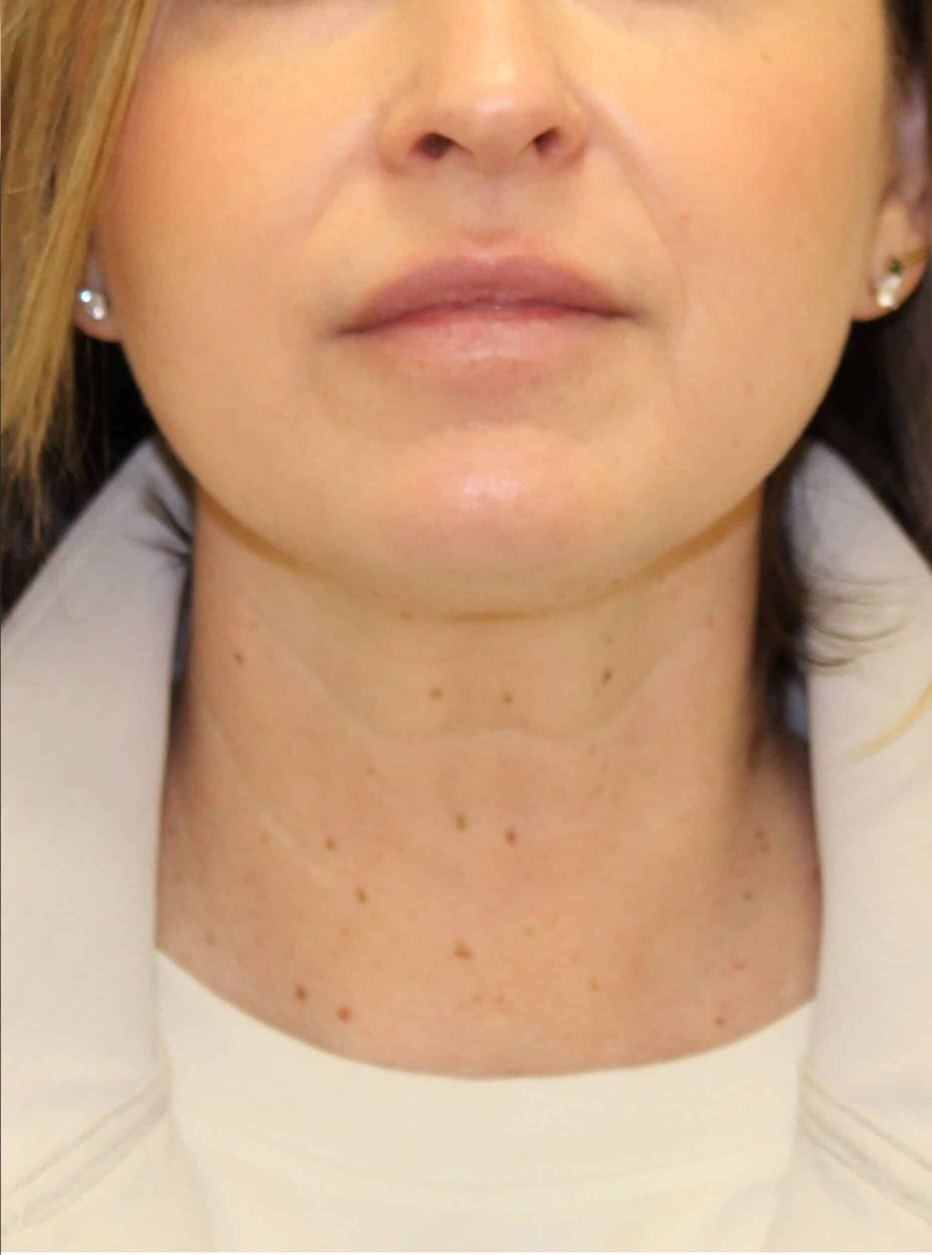 After Image: Timeless Neck Protocol - front