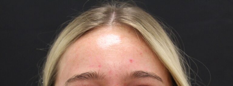 After Image: Neurotoxin - front