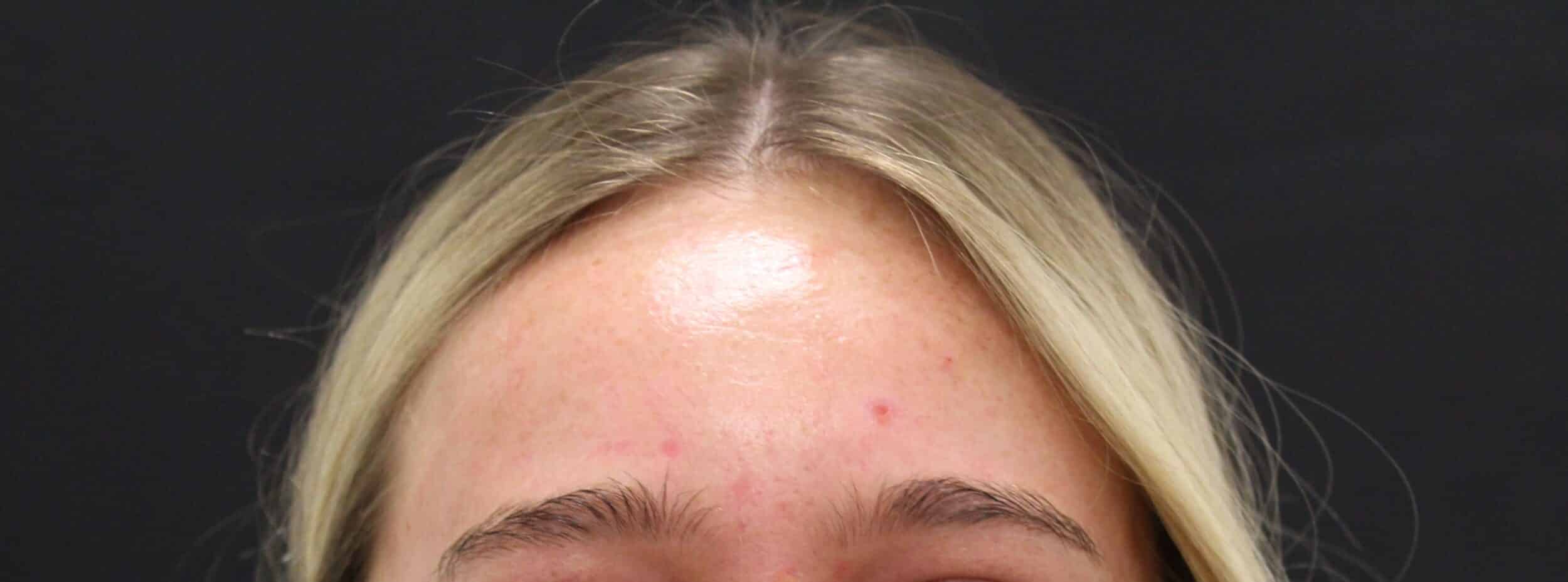After Image: Neurotoxin - front