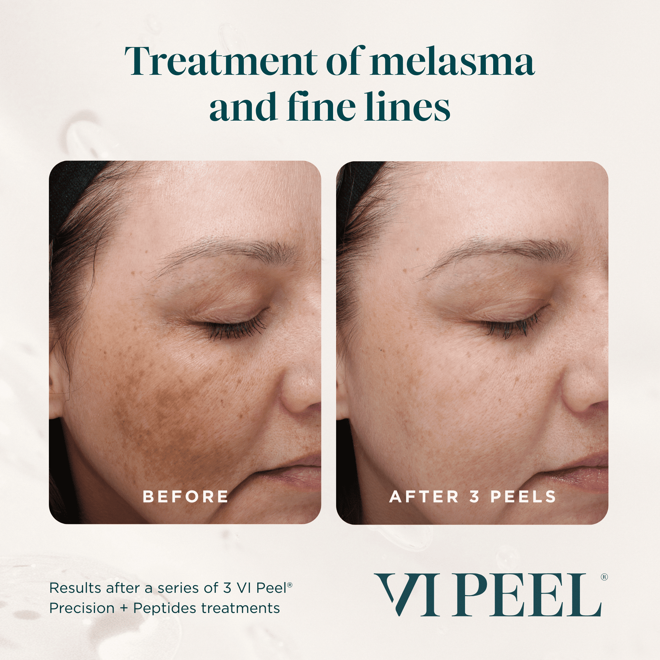 Precision Peptides BA Precision Peptides BA